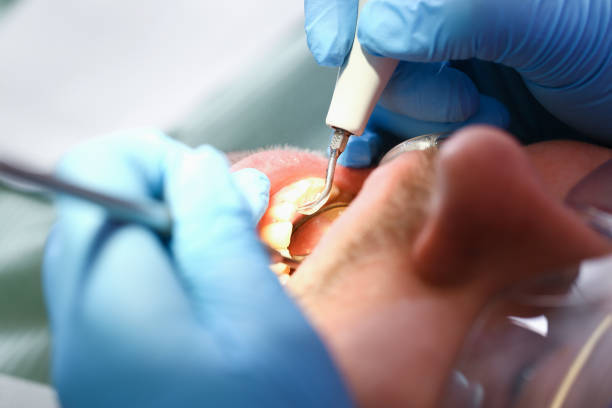 Best 24-Hour Emergency Dentist in Johnson City, TX