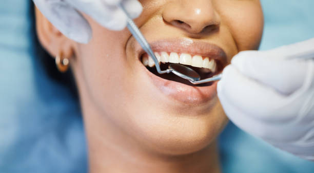 Best Emergency Dental Care for Trauma or Injury in Johnson City, TX