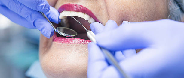 Best Emergency Root Canal Treatment in Johnson City, TX